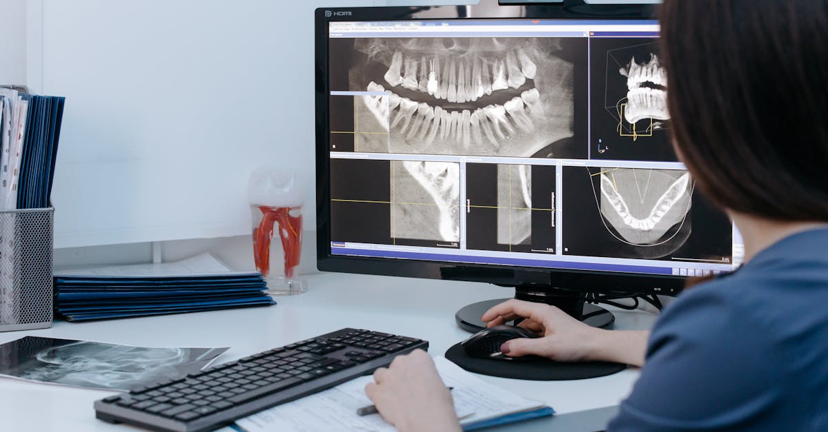 dentist examining dental x rays on a computer screen in a clinic